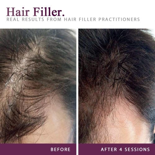 Hair Filler ProActive SA